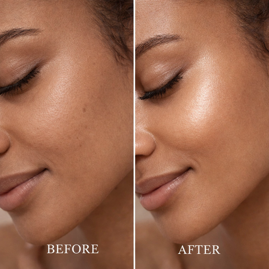 The Refined Skin Tool™ Ultrasonic Pore & Glow Device